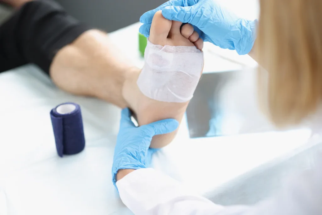 Orthopedic Treatment for Forefoot Ulcers Comprehensive Guide to Care and Healing